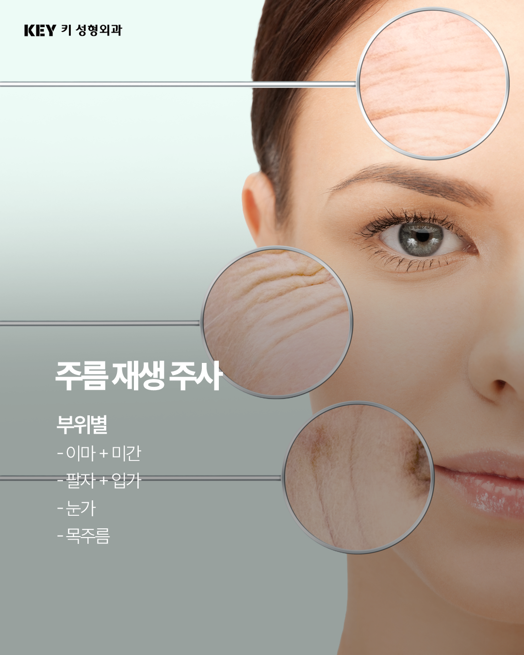주름재생주사