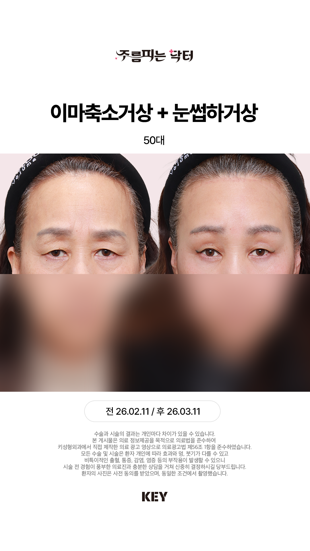 사나운 인상, 찡그리는 모습