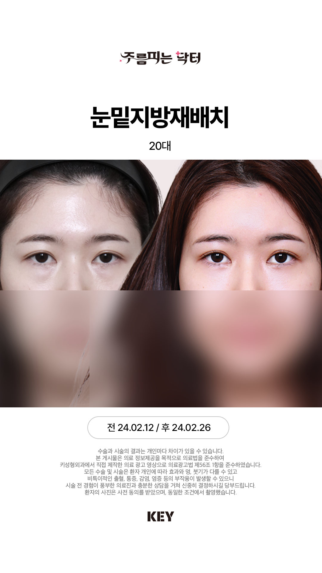 20대 여성