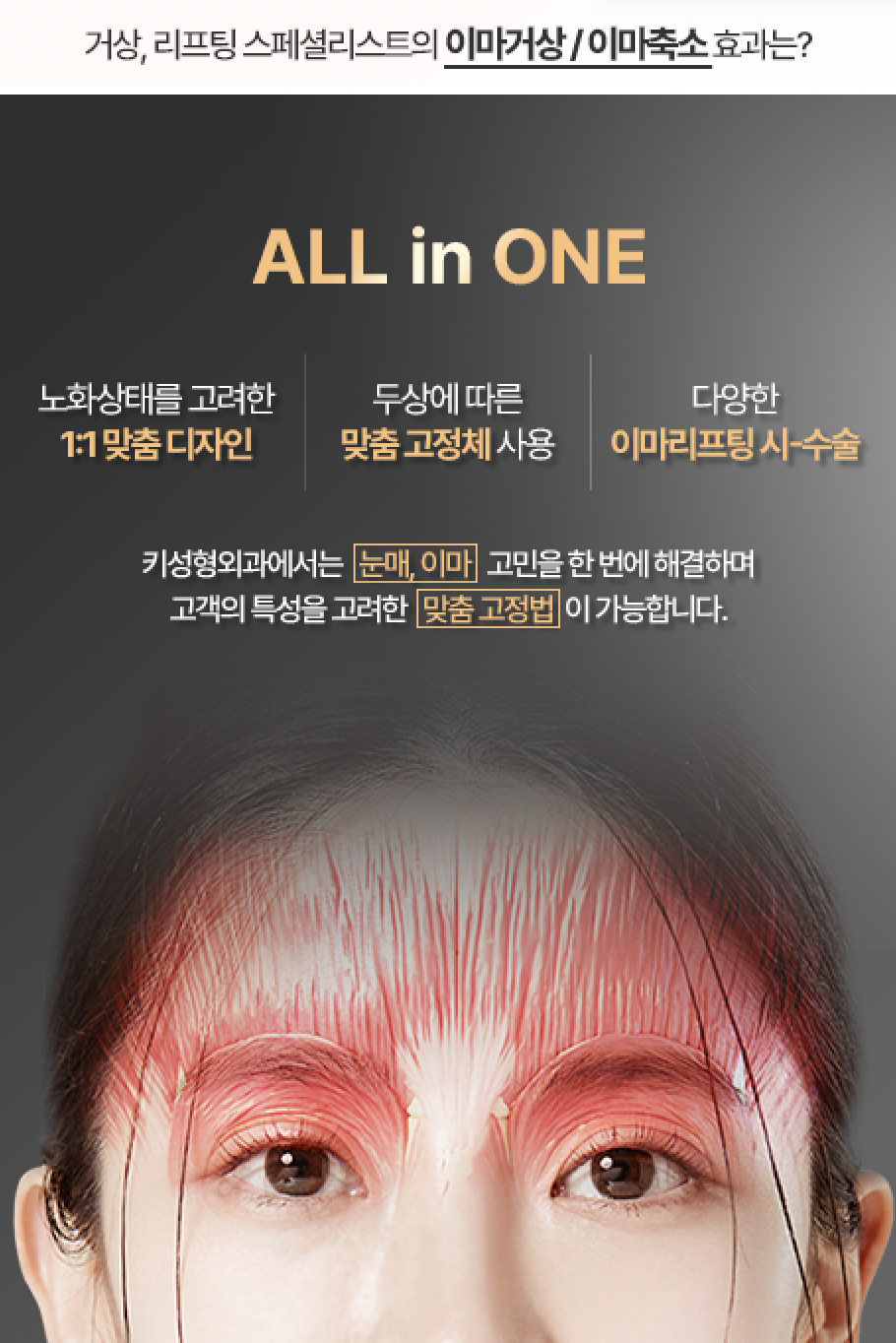 이마거상, 이마축소 모아보기