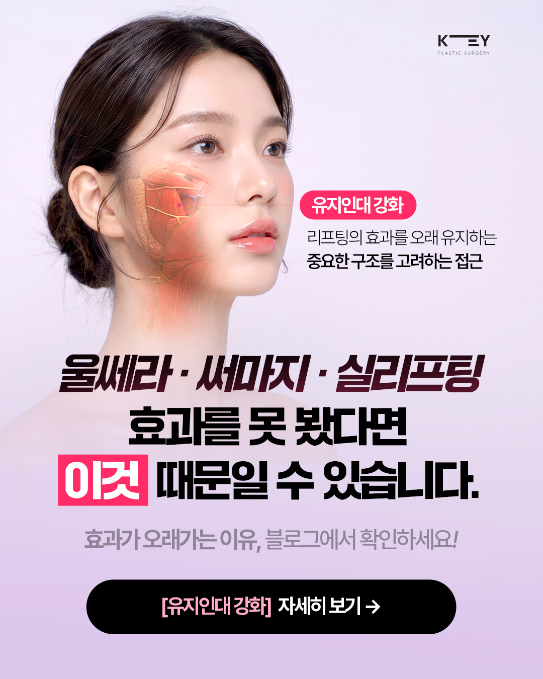 유지인대강화 테크닉